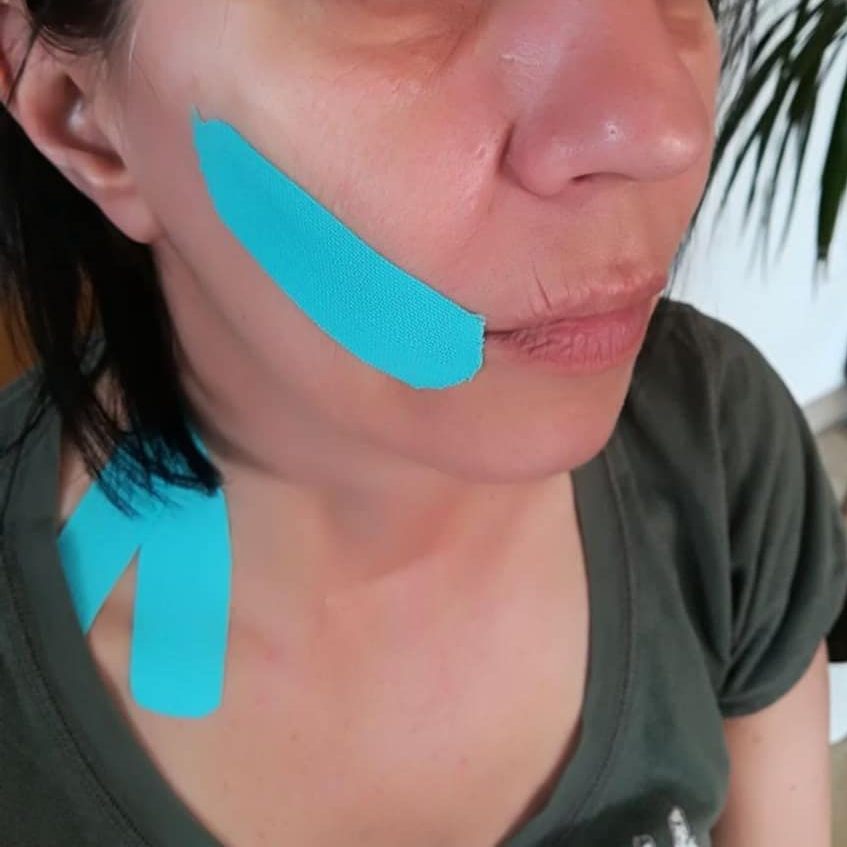 K-Taping - Aufgeklebte Bänder an Wange und Nacken
